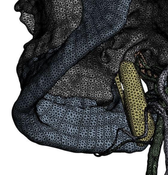 Anatomical FEM model — Full model mesh