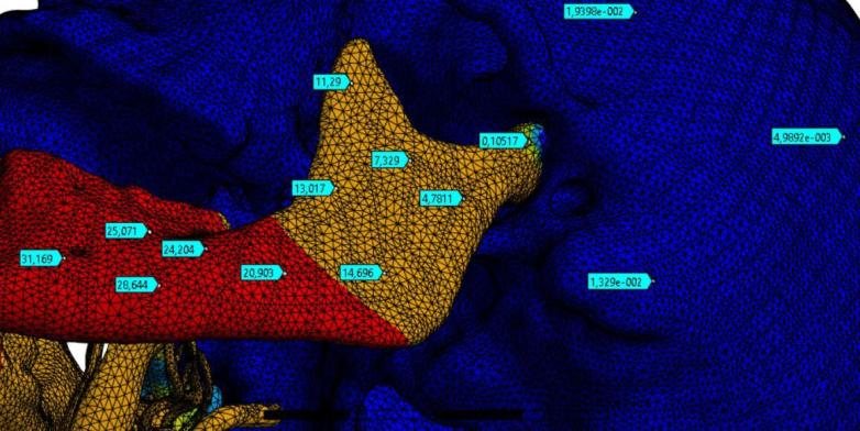 Jaw and nerve interaction — Result map